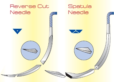Ophthalmic needles